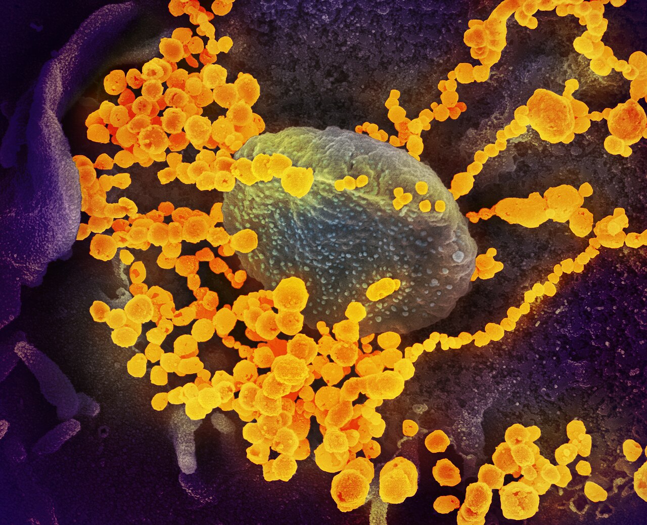 Novel Coronavirus SARS-CoV-2 ; This scanning electron microscope image shows SARS-CoV-2 (round gold objects) emerging from the surface of cells cultur