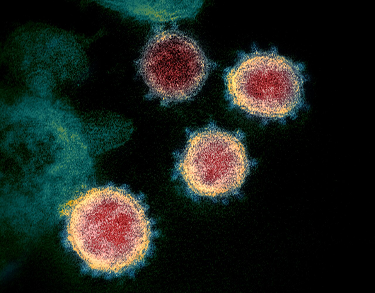 This colorized transmission electron microscope image shows SARS-CoV-2—also known as 2019-nCoV, the virus that causes COVID-19—isolated from a patient