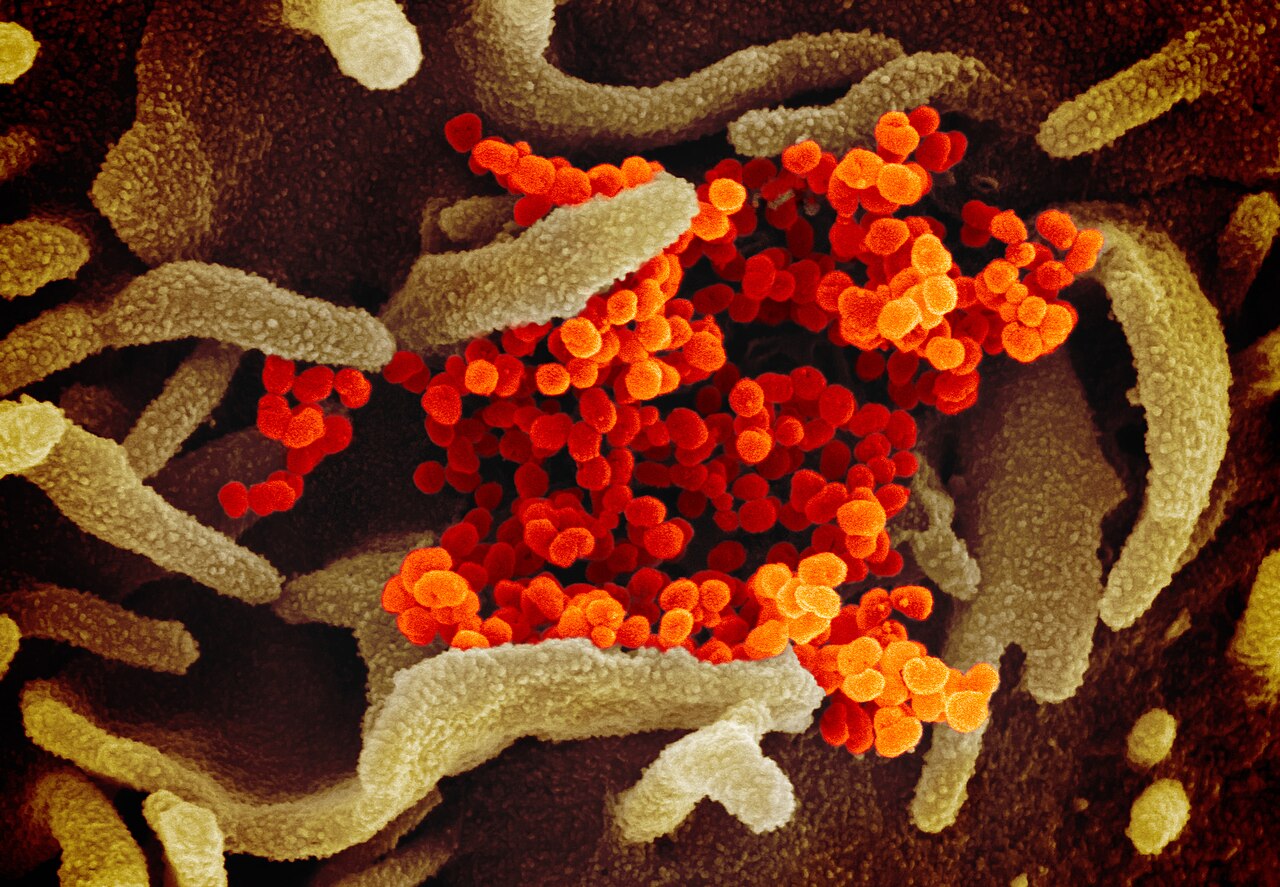 This scanning electron microscope image shows SARS-CoV-2 (orange)—also known as 2019-nCoV, the virus that causes COVID-19—isolated from a patient in t