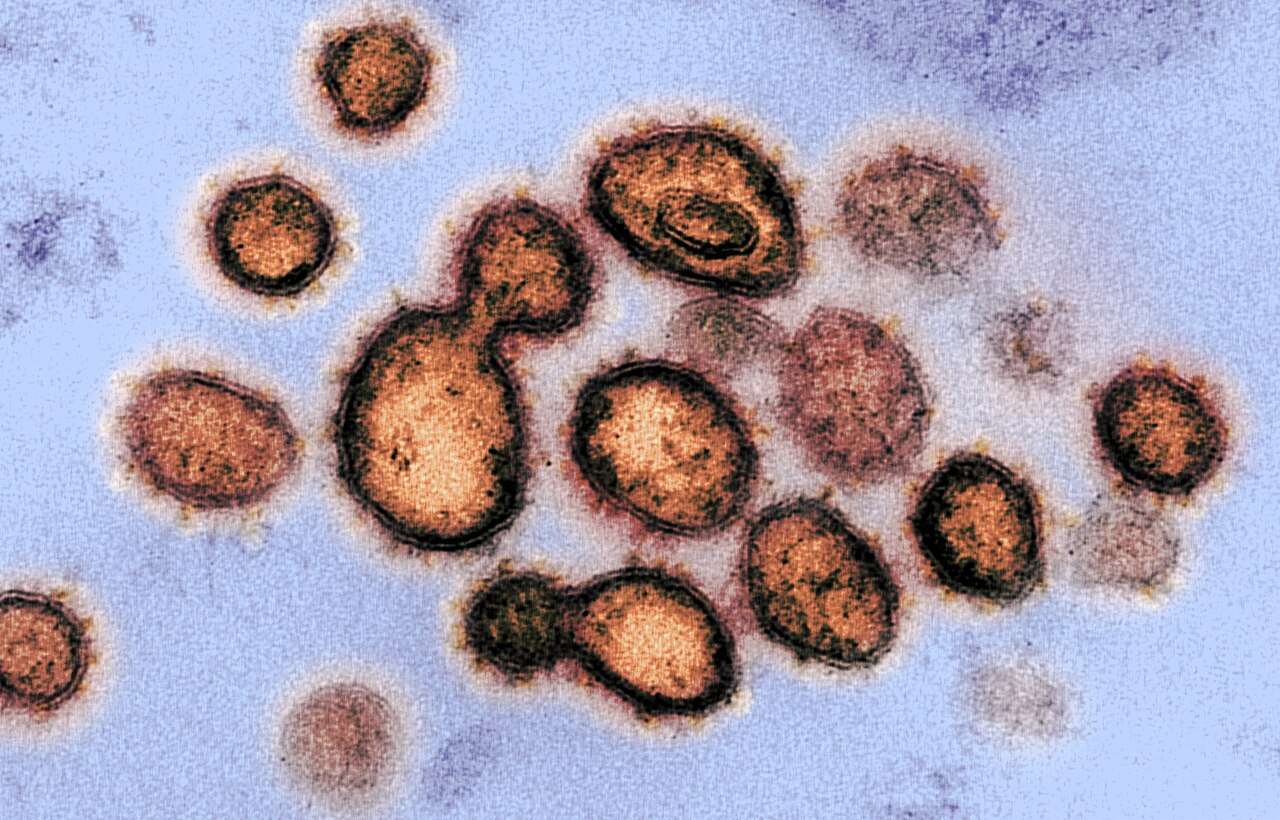 This transmission electron microscope image shows SARS-CoV-2, the virus that causes COVID-19, isolated from a patient in the U.S. Virus particles are