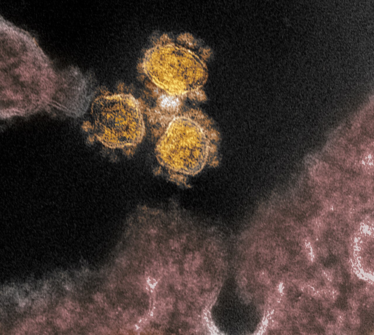 This transmission electron microscope image shows SARS-CoV-2, the virus that causes COVID-19, isolated from a patient in the U.S. Virus particles (rou